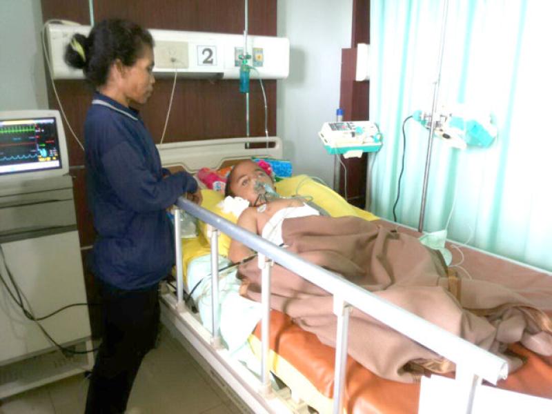 hydrocephalus