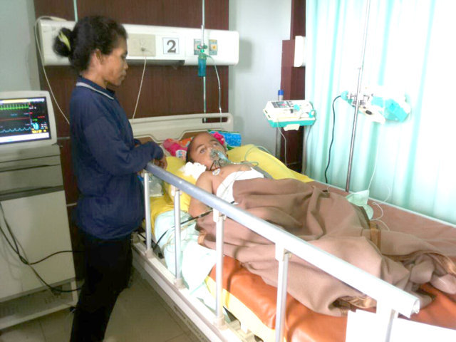 hydrocephalus