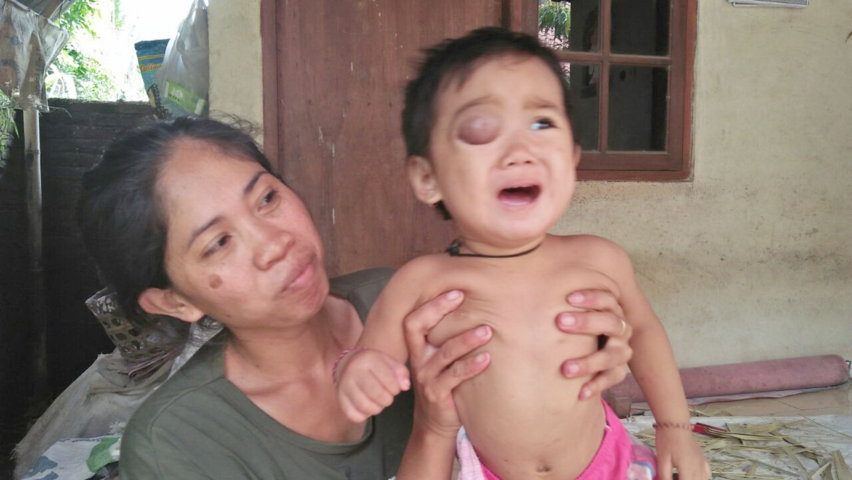 operasi