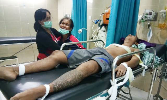 Rabies Renggut Nyawa Gde Karyawan